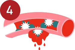 Primary hemostasis step 4.