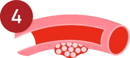 Secondary hemostasis step 4.